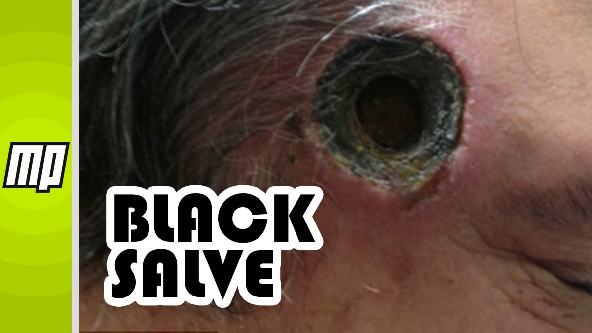 Black Salve 89